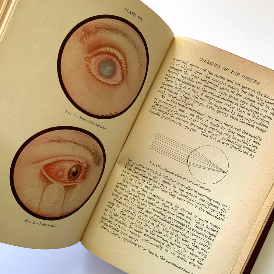 1948 - Diseases of the Eye